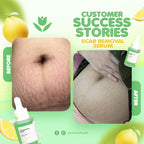 Catt & Co - Scar Removal Serum 30ml - My Care Kits