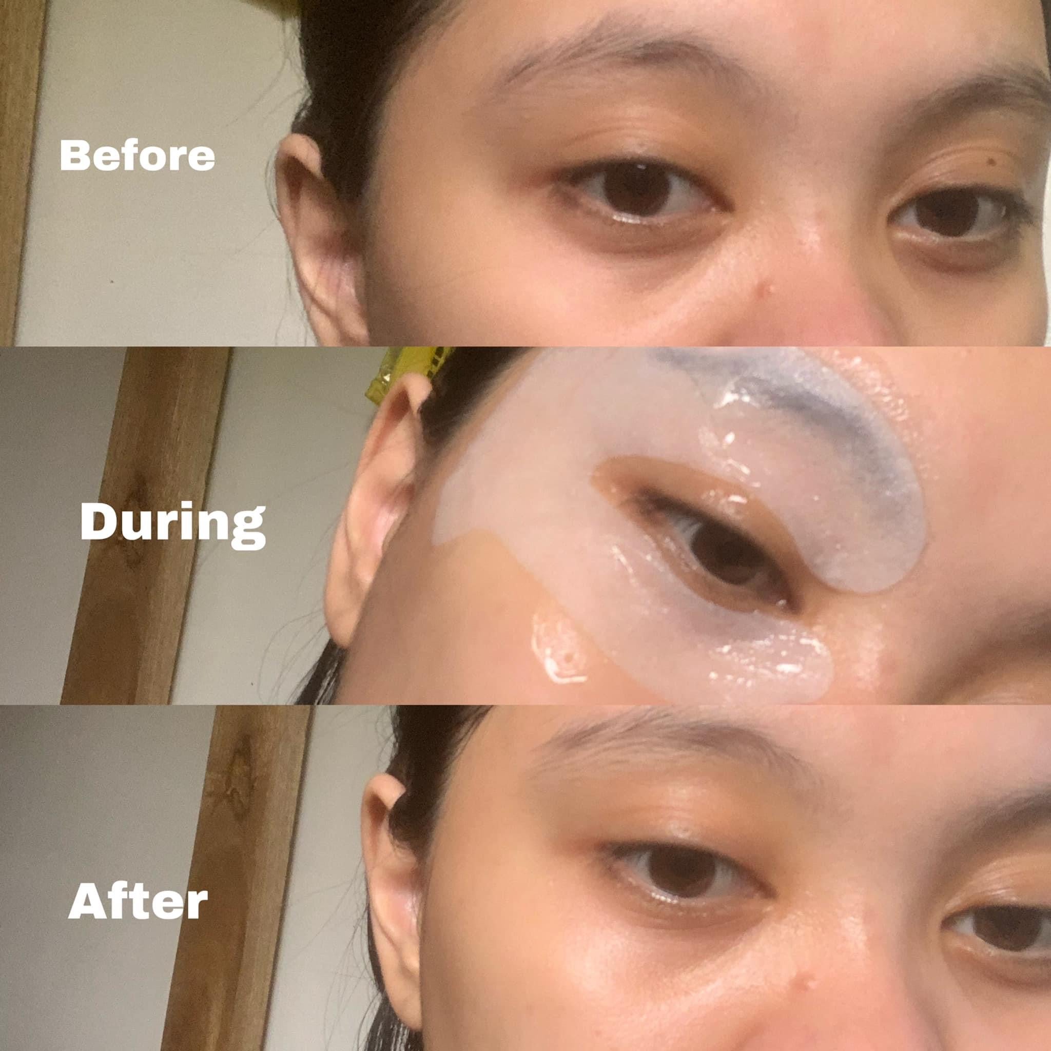 Eye De-Puff Mask - My Care Kits