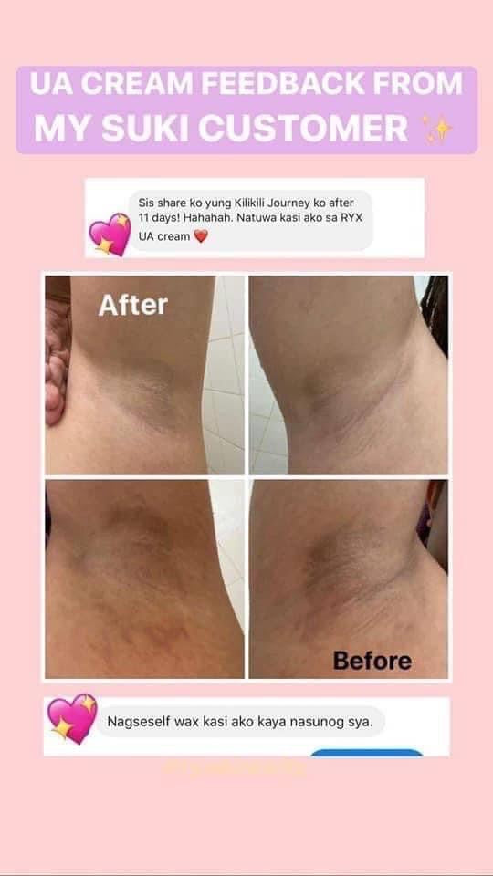 Ryx UA Rescue Cream 30g | Japan Made | Rxyskincerity underarm Cream 30g - My Care Kits