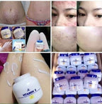 AR Vitamin E Moisturizing Cream Enriched With Sunflower Oil 200g (Blue Lid) - My Care Kits