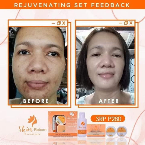 Skin Reborn Rejuvenating Facial set