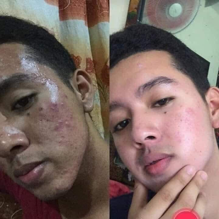 Prestige Rejuvenating set (Pink box) - My Care Kits