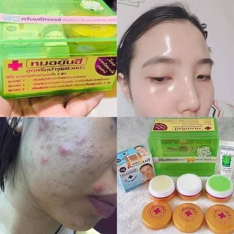 Dr. Yanhee Facial Set - Acne set - GREEN SET