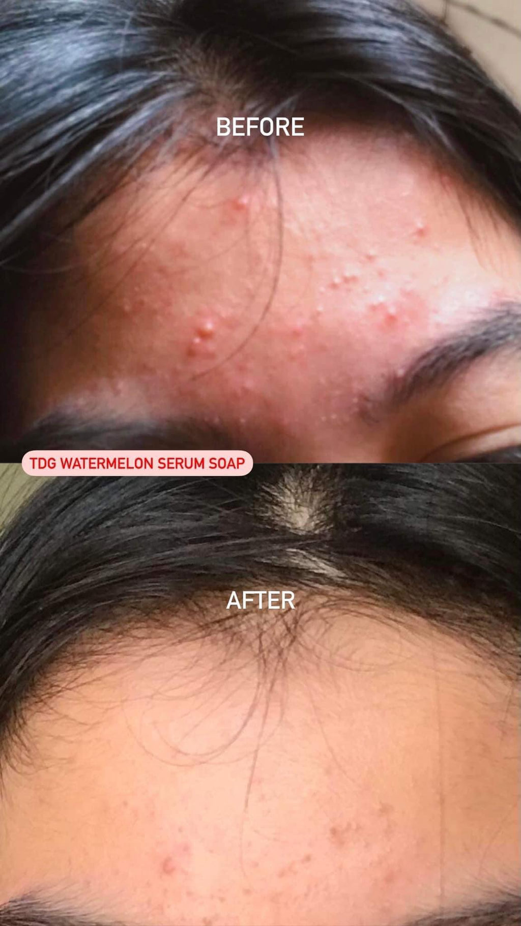 The Daily Glow - Watermelon Serum Soap 135g - My Care Kits