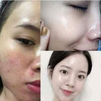 Dr. Yanhee Anti-Aging Facial Set - Purple/Pink set - My Care Kits