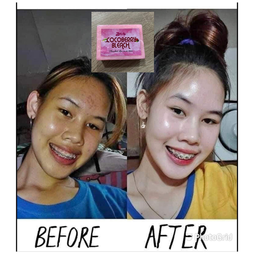 COCOBERRY Soap - Jenna Essence 10pcs - 1kg - My Care Kits