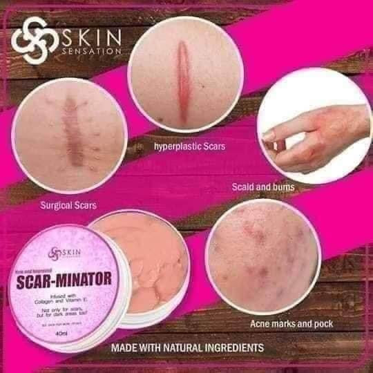 Skin Sensation - New and Improved SCAR-MINATOR 40 ml