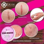 Skin Sensation - New and Improved SCAR-MINATOR 40 ml