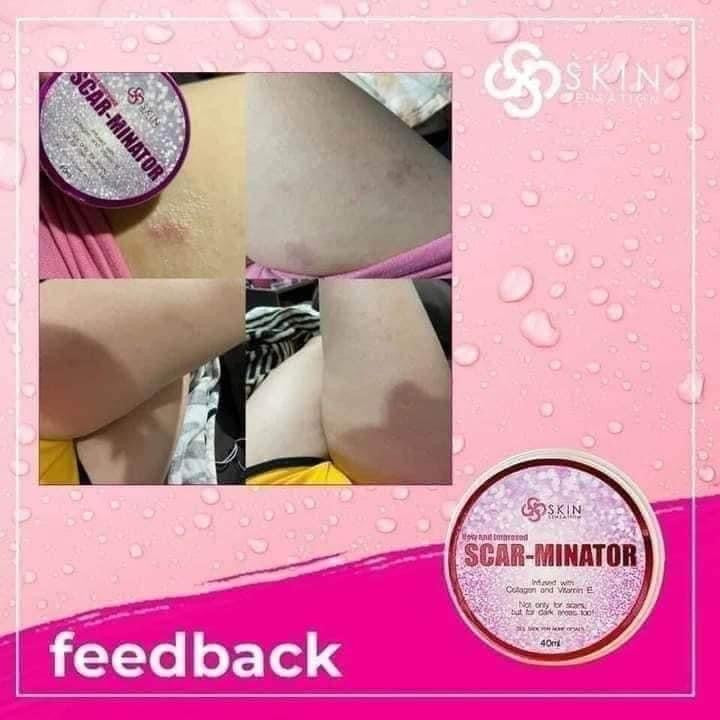 Skin Sensation - New and Improved SCAR-MINATOR 40 ml