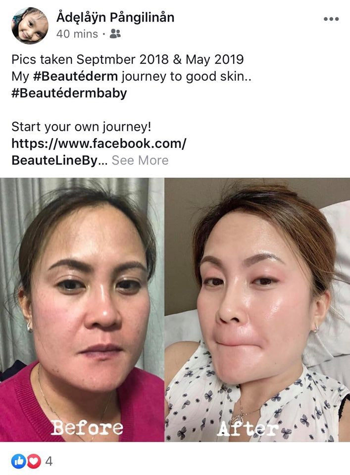 Beautederm Regular Set with upgraded toner 120ml ( large ) - My Care Kits