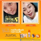 Beauty Vault Premium Rejuvenating set ( NEW PACKAGING ) - My Care Kits