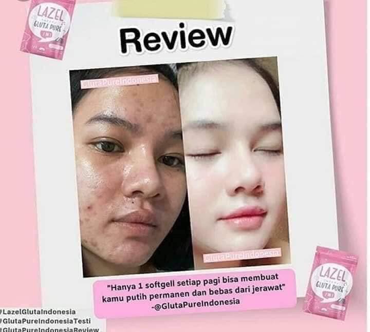 Lazel Gluta Pure 2 in 1 - My Care Kits