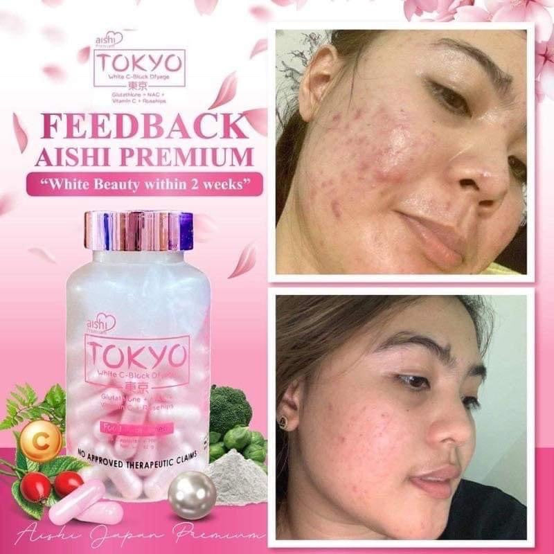 Aishi - TOKYO White C-Block Dfyage - Glutathione 60 Capsule - My Care Kits