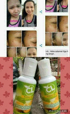 CL Kasoy Oil 60ml - My Care Kits