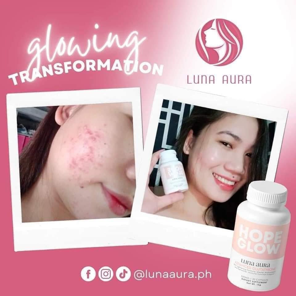 Hope Glow - Luna Aura Advance Glutathione 30 capsule - My Care Kits
