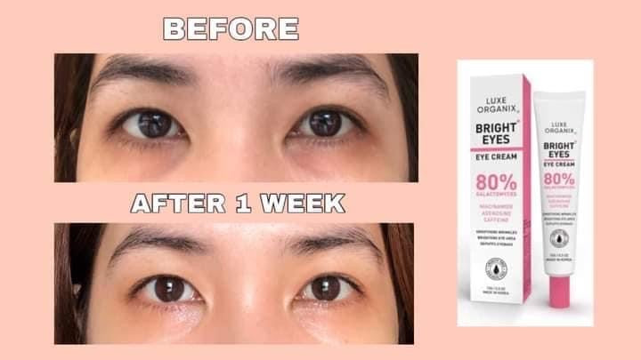 Luxe Organix Bright Eyes Eye Cream - 15g - My Care Kits