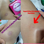 Skin Sensation - New and Improved SCAR-MINATOR 40 ml