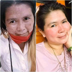 Pekas Eraser Cream 10g