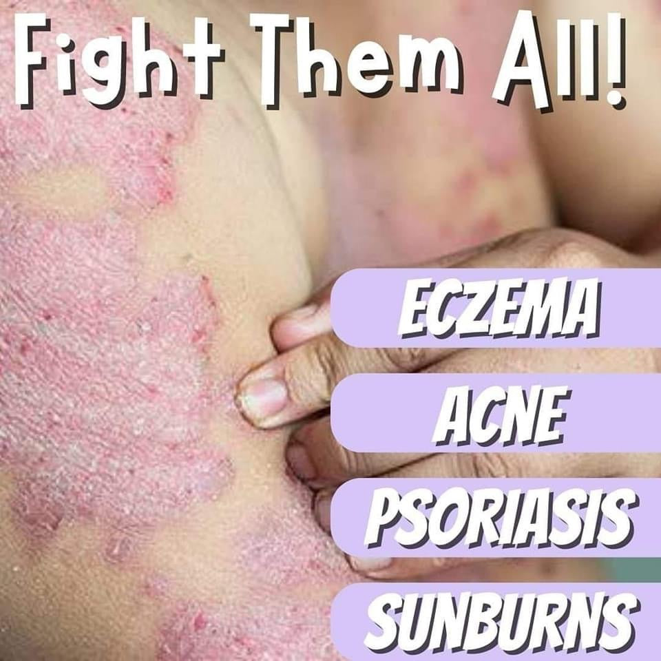 Himalayan Healing Soap 130 g - My Care Kits