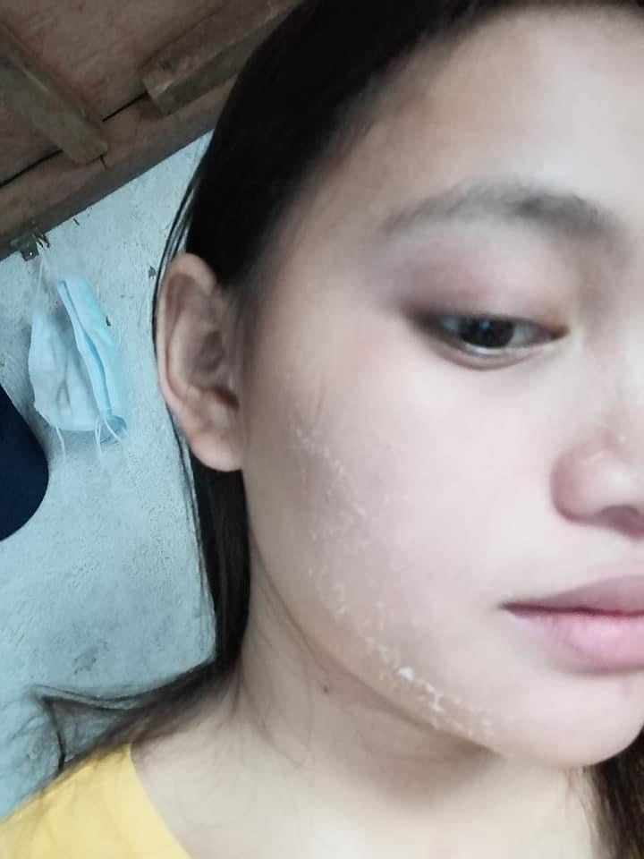 Beauty Vault Premium Rejuvenating set ( NEW PACKAGING ) - My Care Kits