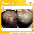 Merry Sun Ginger Scalp Treatment Anti-Hair Loss Shampoo - 400ml - My Care Kits