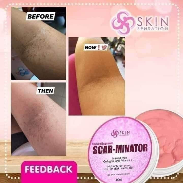 Skin Sensation - New and Improved SCAR-MINATOR 40 ml