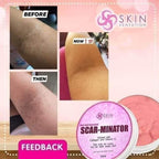 Skin Sensation - New and Improved SCAR-MINATOR 40 ml