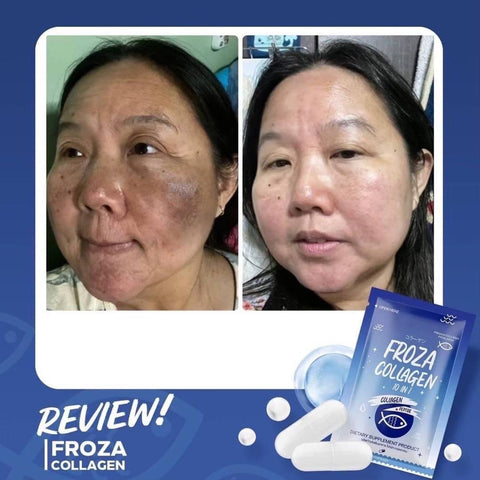 Froza Collagen 10 in 1 - 60 capsule