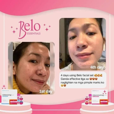Belo Rejuvenating Facial Set - for Acne Prone Skin