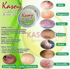 Kasoy cream 10g (1pc) - Facial Tags Removal - My Care Kits