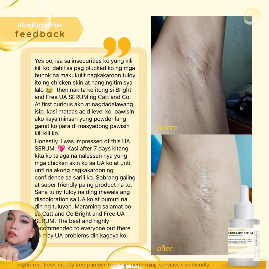 Underarm Serum 30ml - My Care Kits