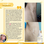 Underarm Serum 30ml - My Care Kits