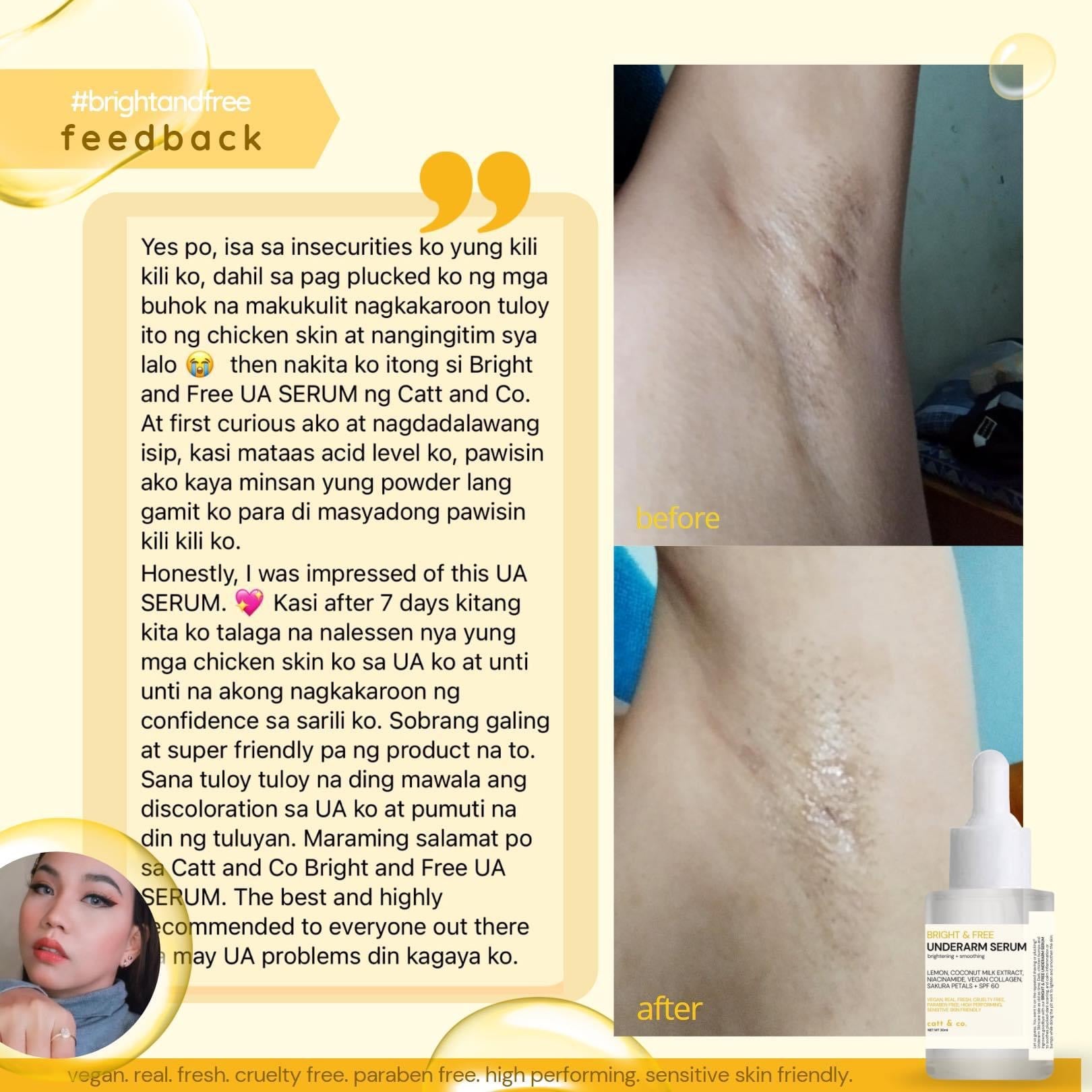 Underarm Serum 30ml - My Care Kits