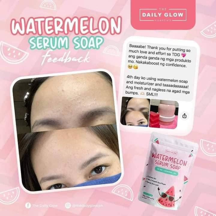 The Daily Glow - Watermelon Serum Soap 135g - My Care Kits
