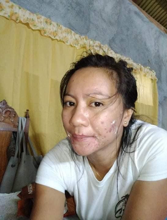 HerSkin SevenDays Facial Set - Seven Days - My Care Kits