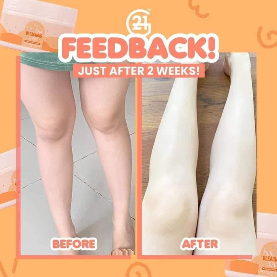 G21 Pure Kojic Bleaching Scrub 300g - My Care Kits