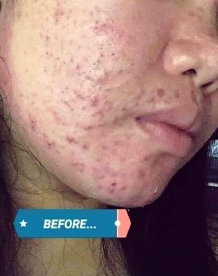 Beauty Vault Premium Rejuvenating set ( NEW PACKAGING ) - My Care Kits