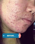 Beauty Vault Premium Rejuvenating set ( NEW PACKAGING ) - My Care Kits