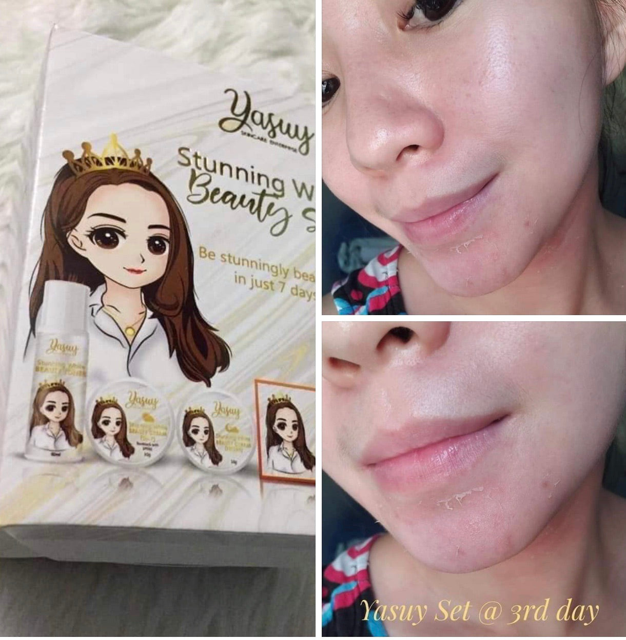 Yasuy Stunning White Beauty Set - My Care Kits