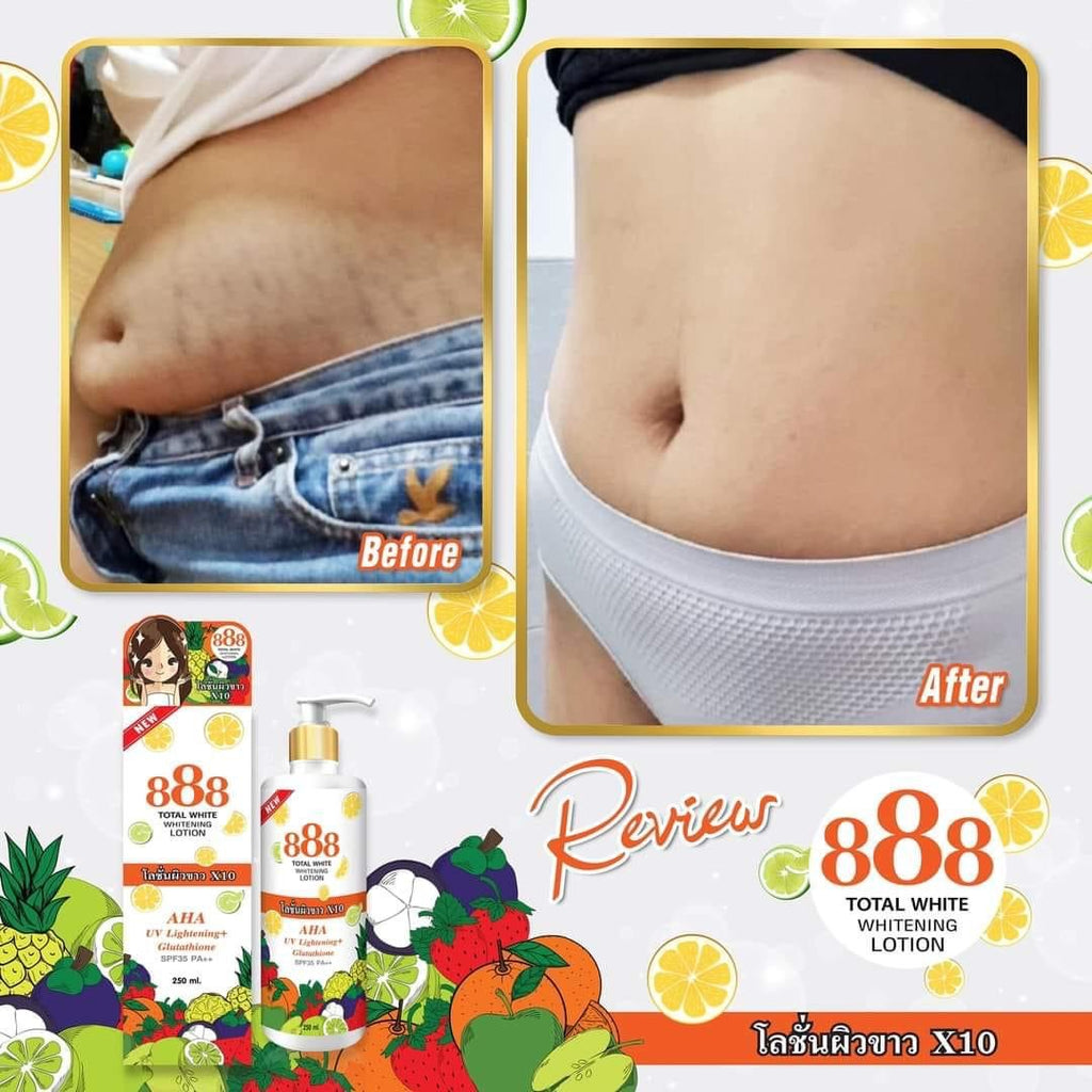 888 Total White Whitening Lotion SPF 35 - My Care Kits