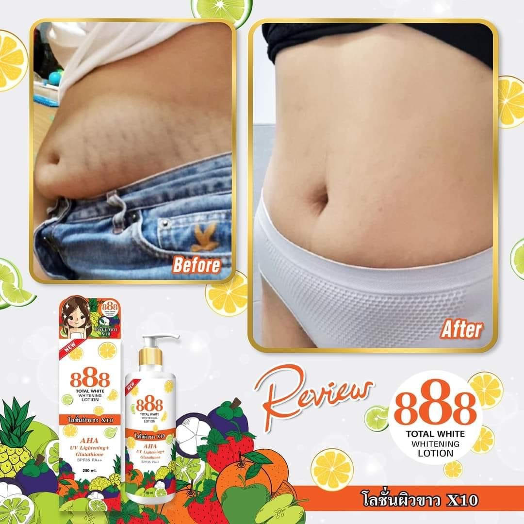 888 Total White Whitening Lotion SPF 35 - My Care Kits