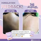 Himalayan Healing Soap 130 g - My Care Kits