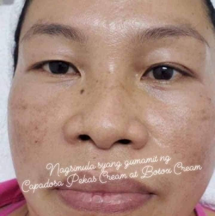 Pekas Eraser Cream 10g