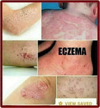 LS BL Cream 7g - My Care Kits