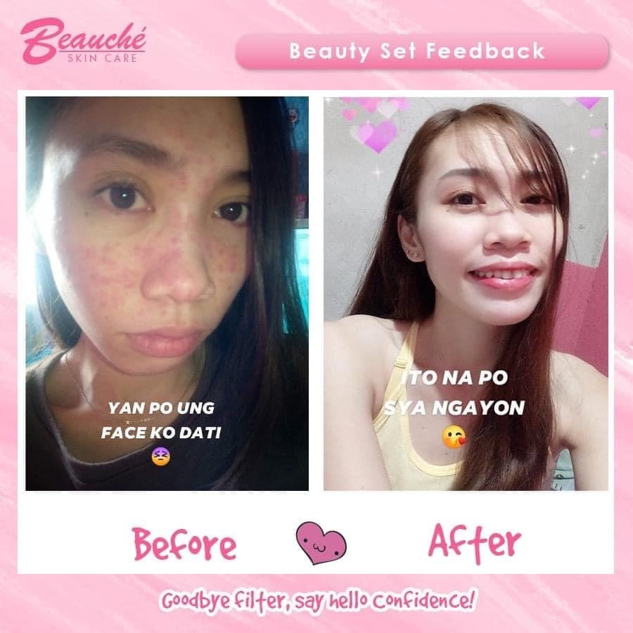 Beauche Skin care Rejuvenating set (light pink box) - My Care Kits