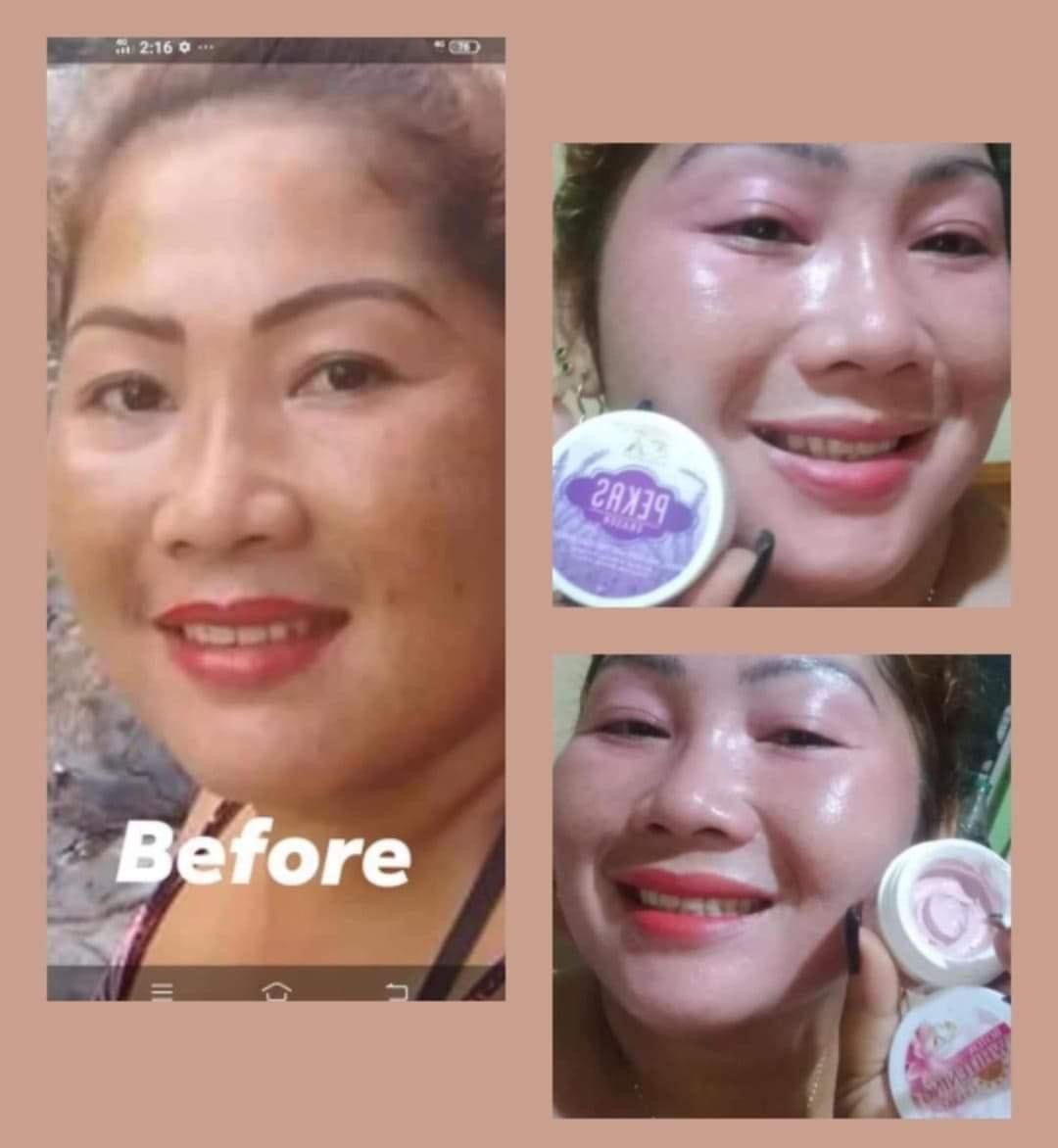 Pekas Eraser Cream 10g