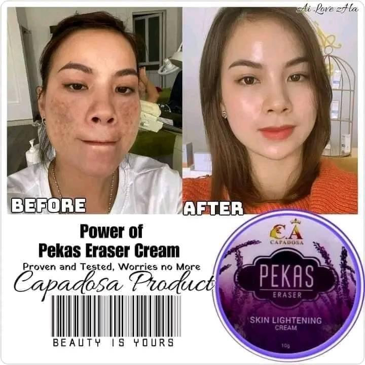 Pekas Eraser Cream 10g