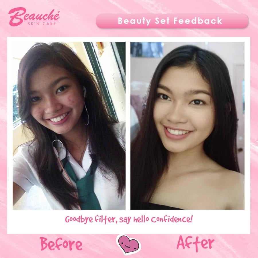 Beauche Skin care Rejuvenating set (light pink box) - My Care Kits