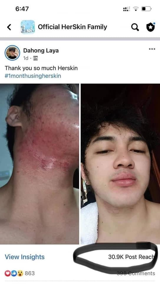 HerSkin Revita-Glow Skin Rescue Set - My Care Kits