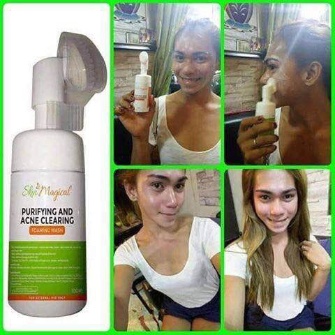 Skin Magical Purifying and Acne Clearing Facial Foaming Wash